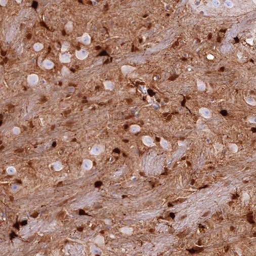 S-RMab® S100B Recombinant Rabbit mAb (SDT-518-45)