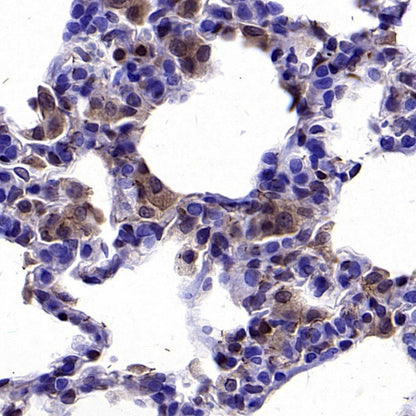 pro-Caspase-1 Recombinant Rabbit mAb (S-2677-22)