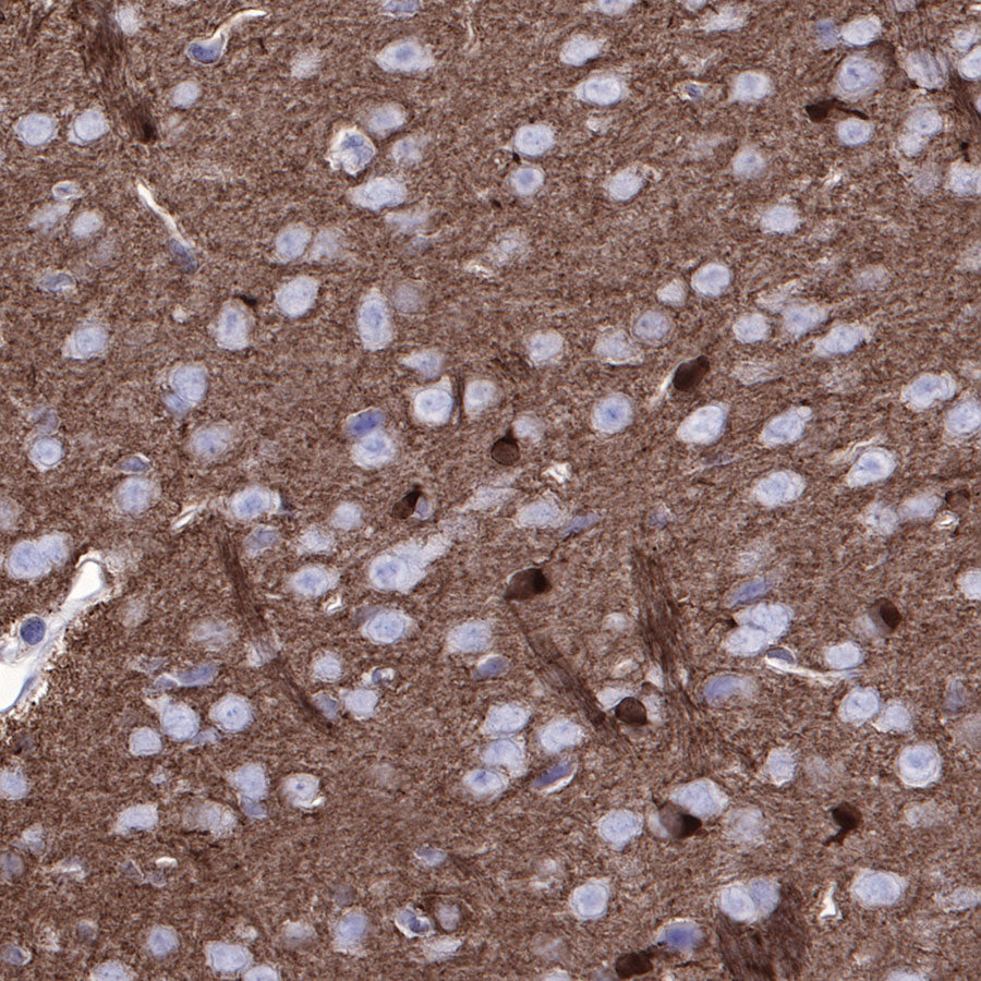 Stathmin 1 Recombinant Rabbit mAb (SDT-383-4)