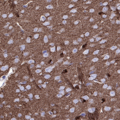 Stathmin 1 Recombinant Rabbit mAb (SDT-383-4)