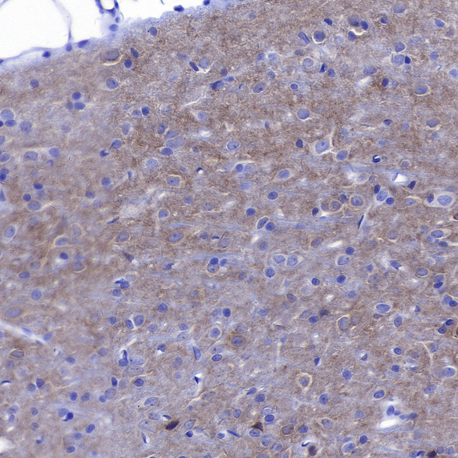 GABRA1 Recombinant Rabbit mAb (S-3254-10)