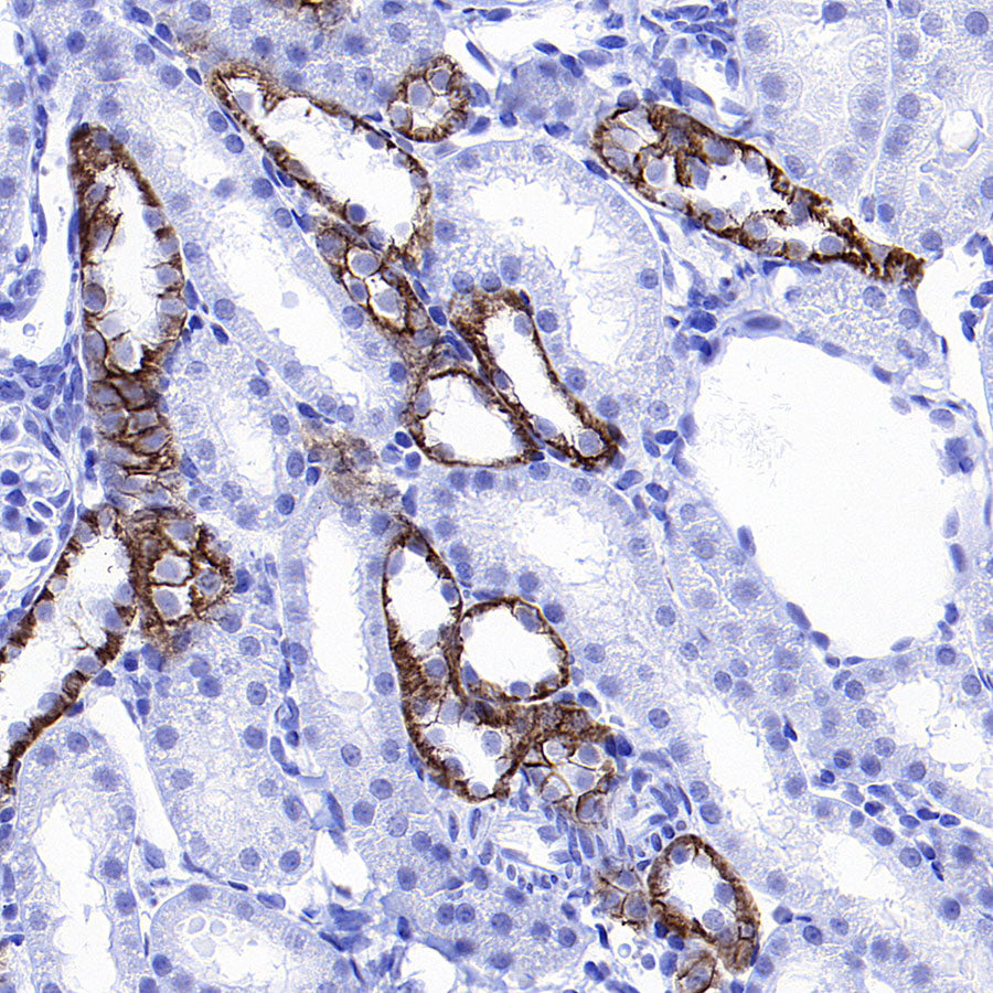 BSND Recombinant Rabbit mAb (S-3815-70)
