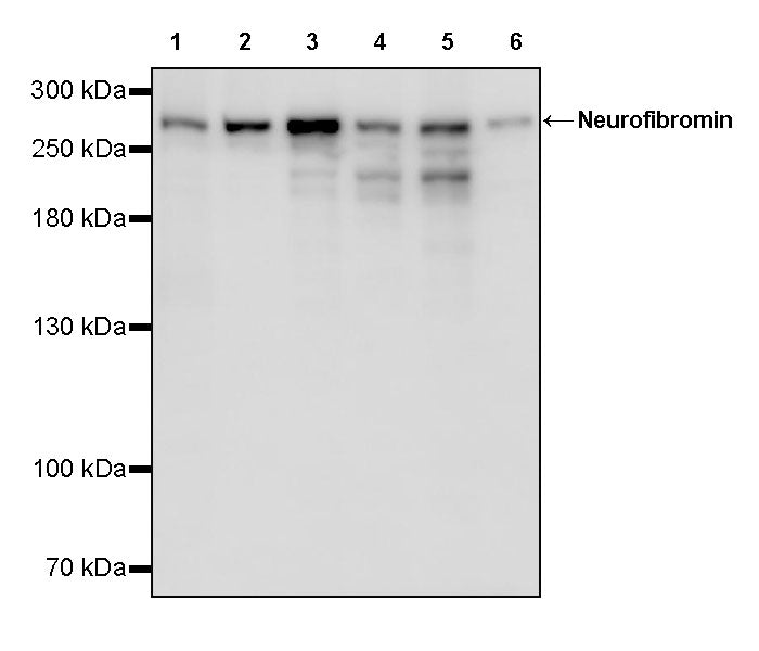 Neurofibromin Recombinant Rabbit mAb (S-3540-15)