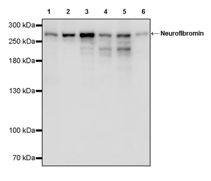Neurofibromin Recombinant Rabbit mAb (S-3540-15)