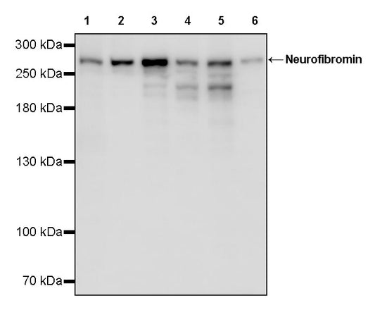 Neurofibromin Recombinant Rabbit mAb (S-3540-15)