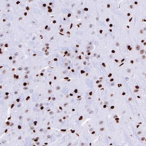 HMGB1 Recombinant Rabbit mAb (S-R305)
