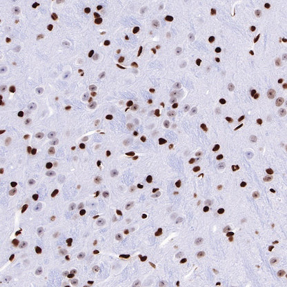 HMGB1 Recombinant Rabbit mAb (S-R305)