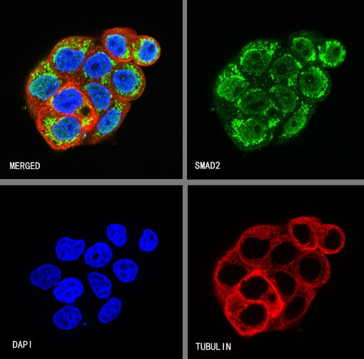 SMAD2 Recombinant Rabbit mAb (S-1521-177)