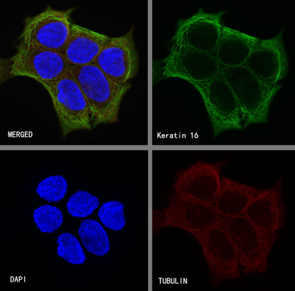 Keratin 16 Recombinant Rabbit mAb (S-R306)