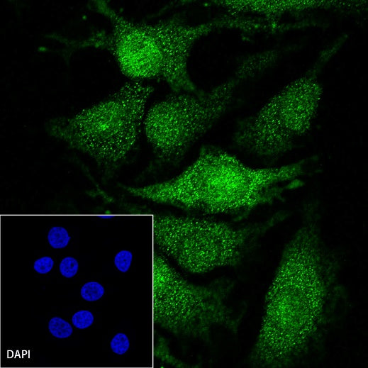 p38 MAPK Recombinant Rabbit mAb (S-508-19)