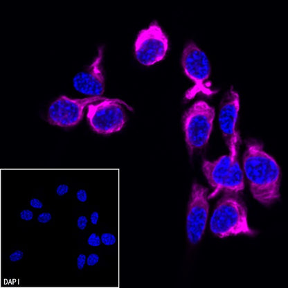 Vimentin Recombinant Rabbit mAb (Alexa Fluor® 647 Conjugate) (S-029-20)