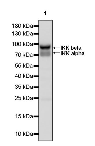 IKK alpha/beta Recombinant Rabbit mAb (S-1317-27)