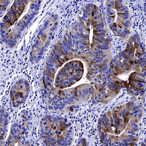 Lipocalin-2/NGAL Recombinant Rabbit mAb (S-2279-72)