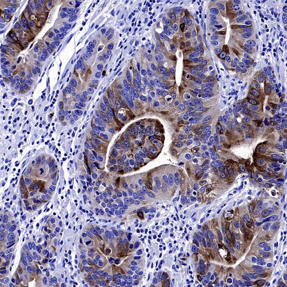 Lipocalin-2/NGAL Recombinant Rabbit mAb (S-2279-72)