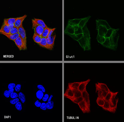 S-RMab® GLUT1 Recombinant Rabbit mAb (SDT-047-53)