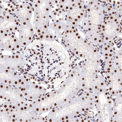 SF2 Recombinant Rabbit mAb (S-1845-27)