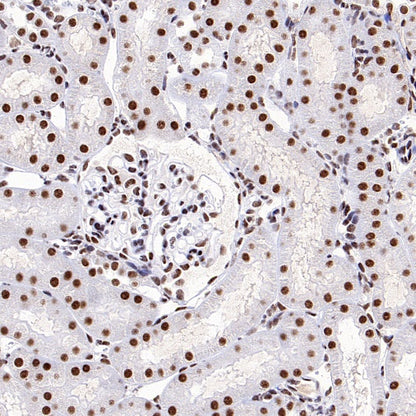 SF2 Recombinant Rabbit mAb (S-1845-27)