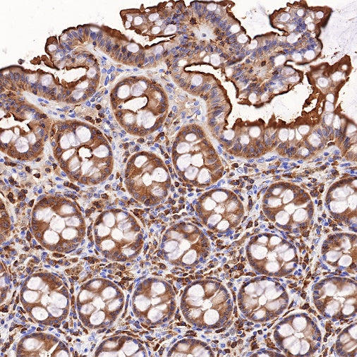 Ezrin Recombinant Rabbit mAb (S-R358)