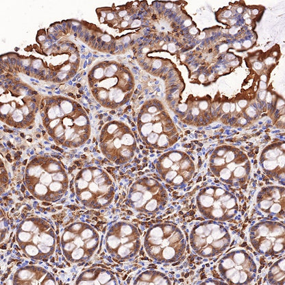 Ezrin Recombinant Rabbit mAb (S-R358)