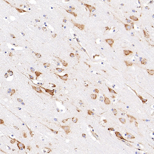 P4HB Recombinant Rabbit mAb (S-1524-120)