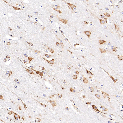 P4HB Recombinant Rabbit mAb (S-1524-120)