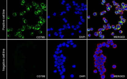 S-RMab® CD79B Recombinant Rabbit mAb (SDT-R513)