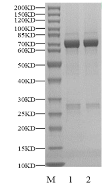 CSF1R(FMS) GST Tag Protein, Human