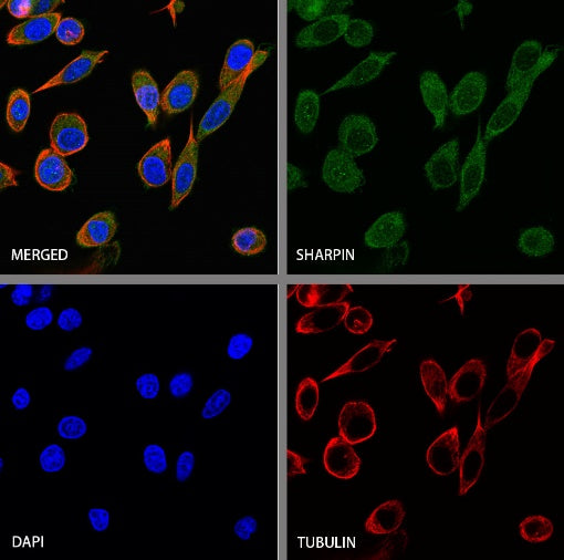 SHARPIN Recombinant Rabbit mAb (S-2356-308)