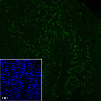 S-RMab® p53 Recombinant Rabbit mAb (SDT-R118)