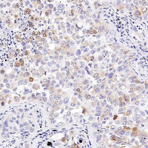 Mrp4 Recombinant Rabbit mAb (S-2305-17)