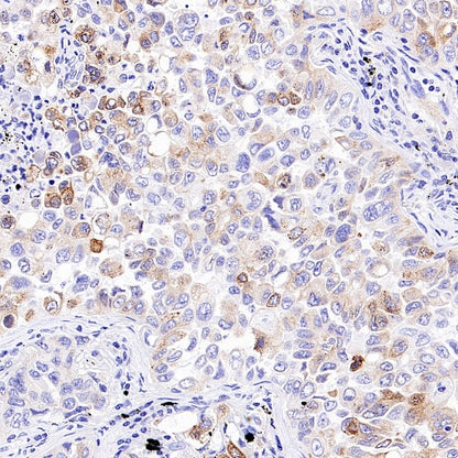 Mrp4 Recombinant Rabbit mAb (S-2305-17)