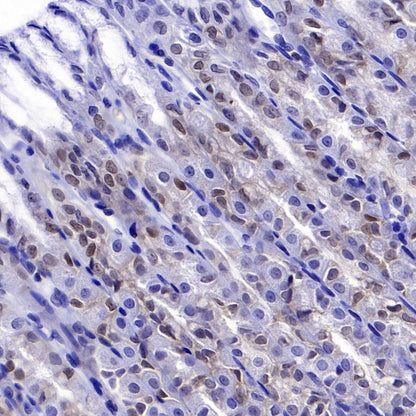 PDCD4 Rabbit polyclonal antibody