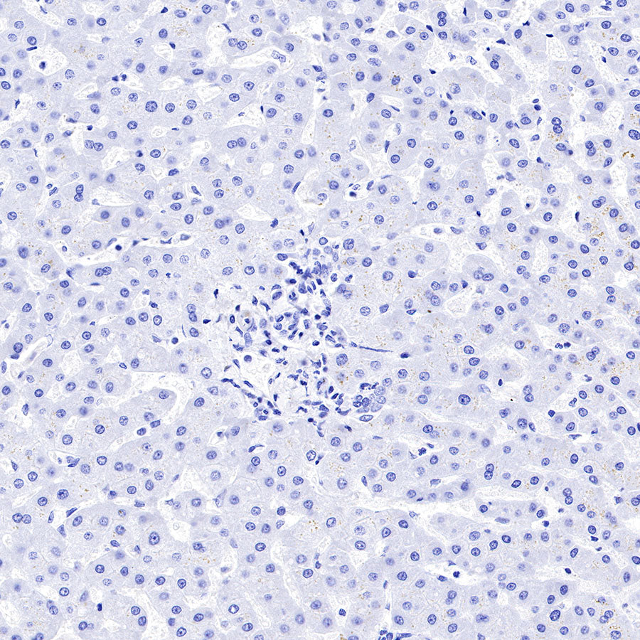 CGA/HCG-α Recombinant Rabbit mAb (SDT-227-66)