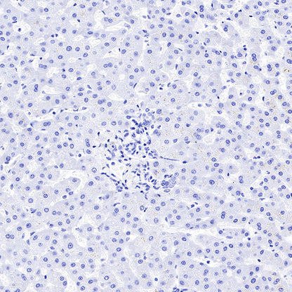 CGA/HCG-α Recombinant Rabbit mAb (SDT-227-66)