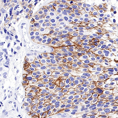 CD44v6 Mouse mAb (S-945-76)