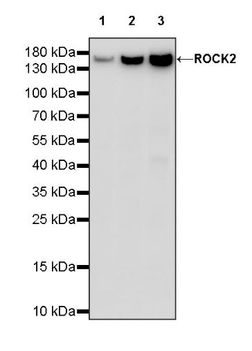 ROCK2 Rabbit Polyclonal Antibody