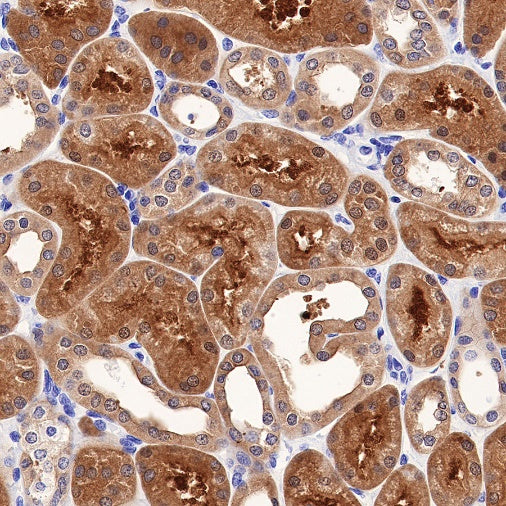 LDH-C/A Recombinant Rabbit mAb (S-R328)