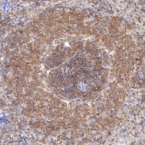 NF-κB p105/p50 Rabbit polyclonal antibody