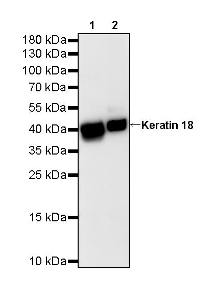 S-RMab® Keratin 18 Recombinant Rabbit mAb (SDT-012-7)