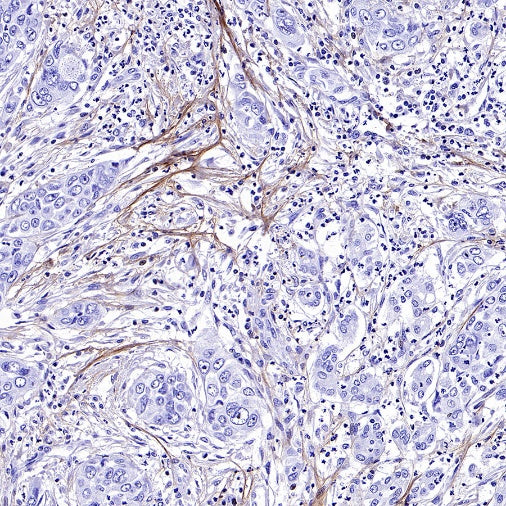 Collagen III Recombinant Mouse mAb (S-3838)