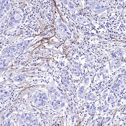 Collagen III Recombinant Mouse mAb (S-3838)