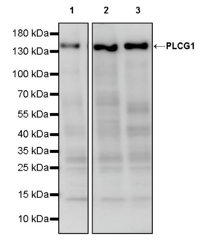 PLCG1 Recombinant Rabbit mAb (S-978-37)