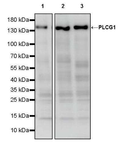 PLCG1 Recombinant Rabbit mAb (S-978-37)