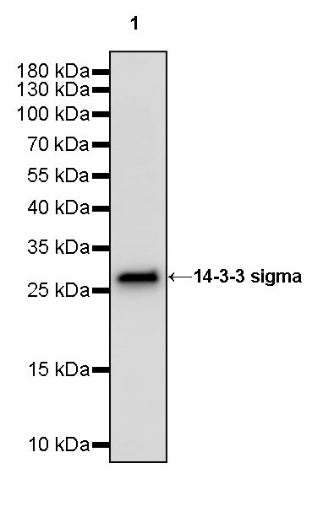 14-3-3 sigma Recombinant Rabbit mAb (S-2017-59)