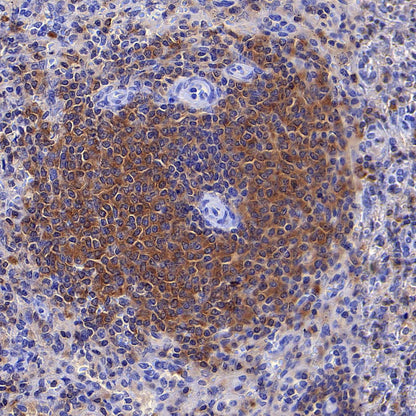 ARHGAP25 Recombinant Rabbit mAb (S-4005-5)
