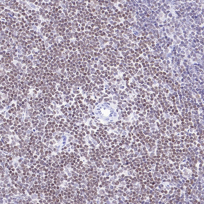 Caspase-8 Recombinant Rabbit mAb (S-2676-74)