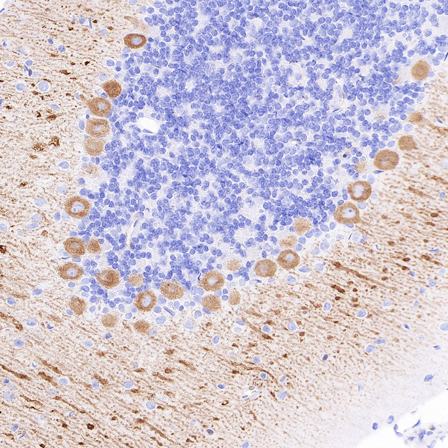 ITPR1 Recombinant Rabbit mAb (S-4530-47)