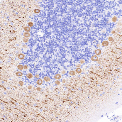 ITPR1 Recombinant Rabbit mAb (S-4530-47)