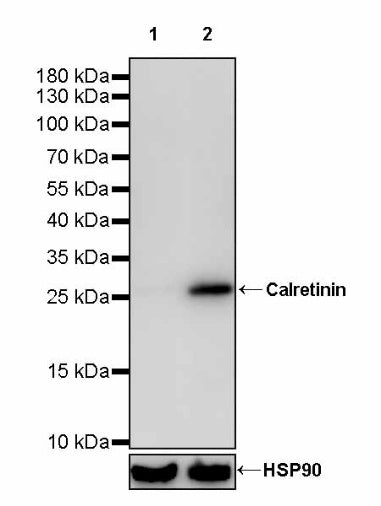 Calretinin Recombinant Rabbit mAb (SDT-2773-21)