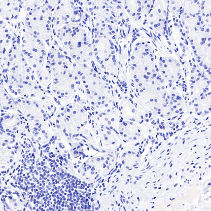 PAPP-A Recombinant Rabbit mAb (SDT-226-46)